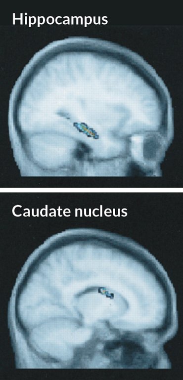 Bộ nhớ outsourcing