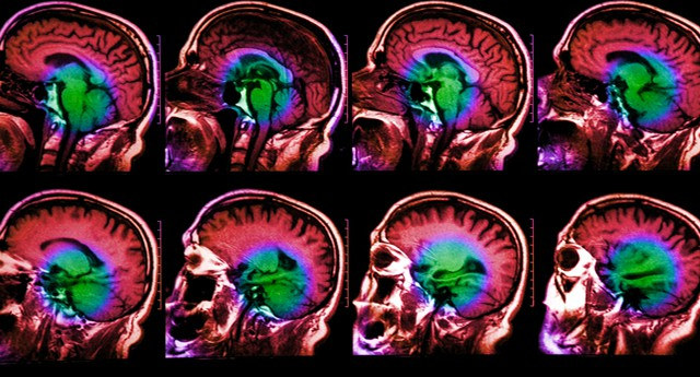 Bộ não của con người 