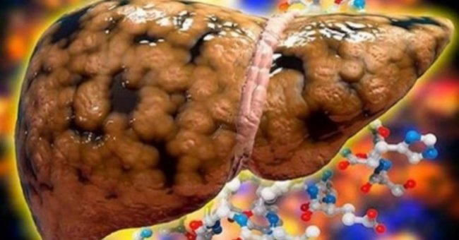 Chanh là "người bạn tốt" của lá gan