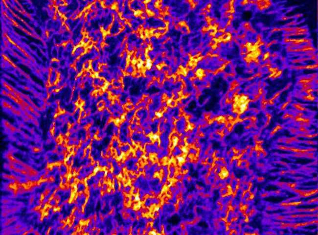 Cholesterol được phân bố trong tế bào 