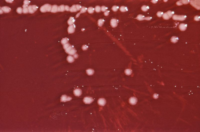 Khuẩn Pseudomonas