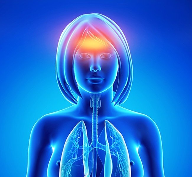 Nhức đầu Nhức đầu