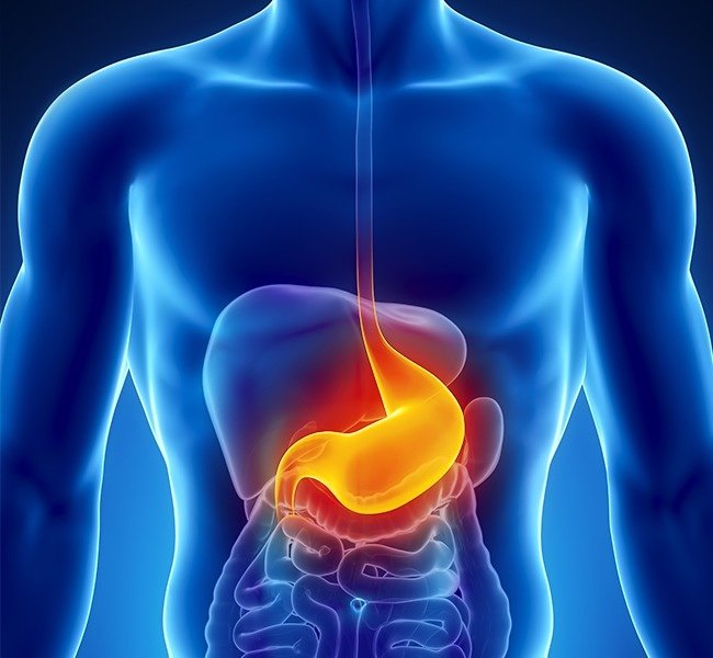 Đau dạ dày Đau dạ dày