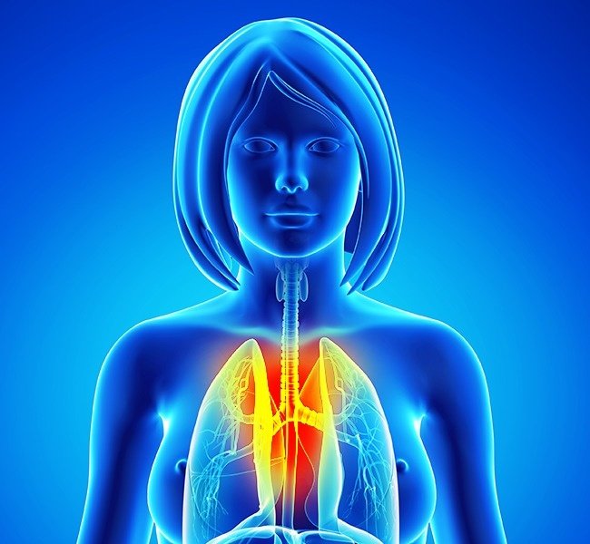 Đau ngực Đau ngực