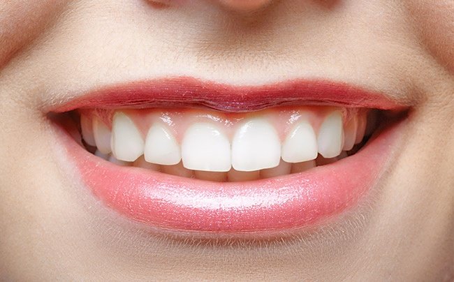 Môi trên rất mỏng Môi trên rất mỏng