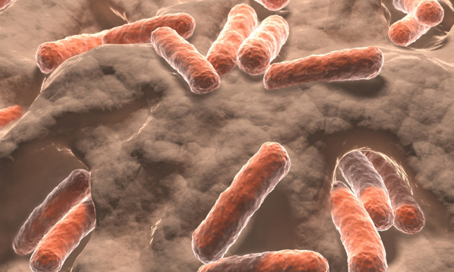 Vi khuẩn kháng thuốc 