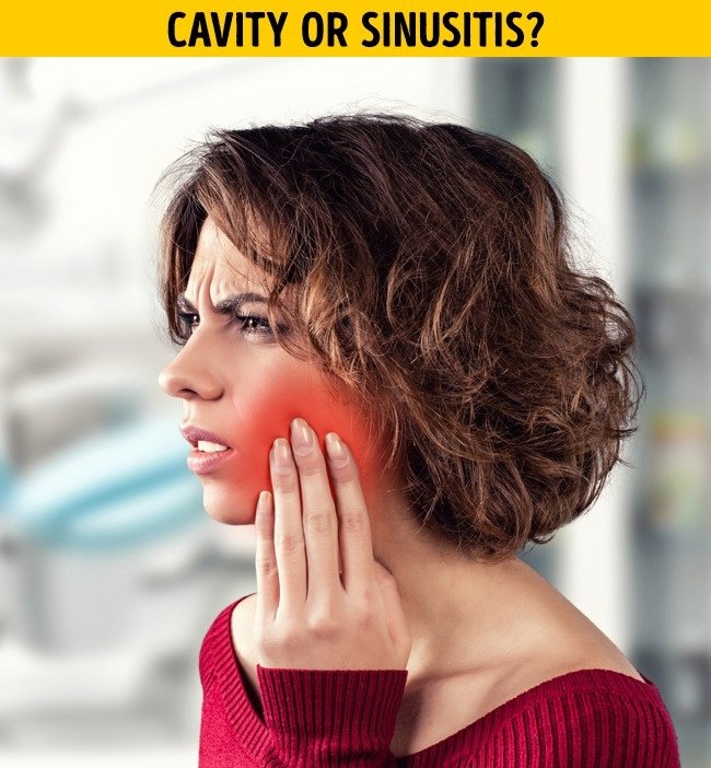 Đau răng không có nghĩa là sâu răng