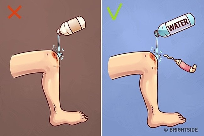 Rửa vết thương bằng cồn hoặc oxy già