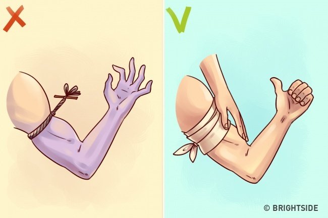 Cầm máu khi bị thương