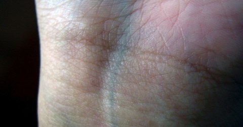 Tại sao tĩnh mạch của con người có màu xanh trong khi máu có màu đỏ?