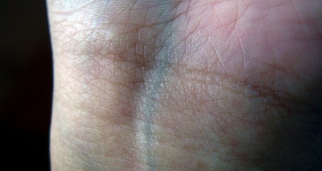 Tĩnh mạch của con người có màu xanh   Tĩnh mạch của con người có màu xanh