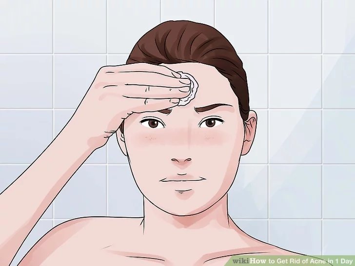 Dùng chất làm se cho vùng da mụn trứng cá