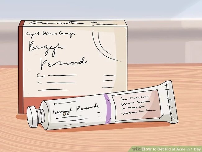 Thử dùng benzoyl peroxide