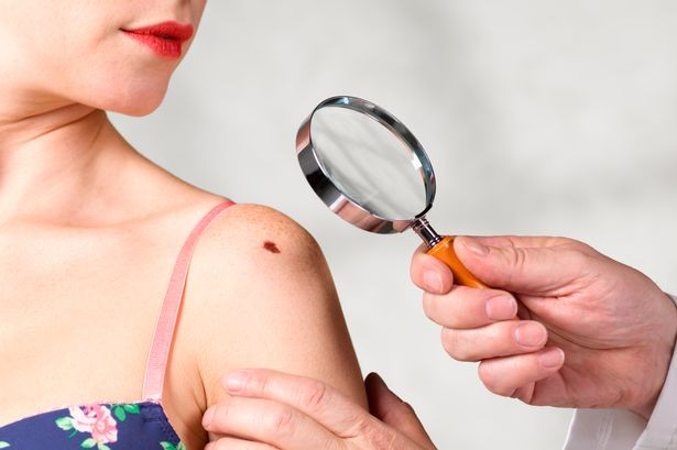 Có những khối u nổi dưới da