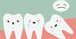 Nhận biết những triệu chứng khi mọc răng khôn để có cách đối phó tốt hơn