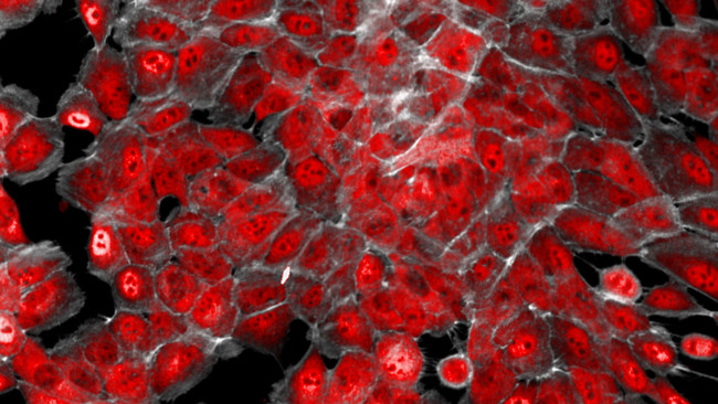 Kháng thể mới đã làm giảm sự phát triển khối u