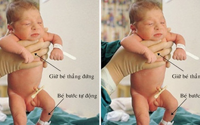 Phản xạ bước đi của trẻ sơ sinh 