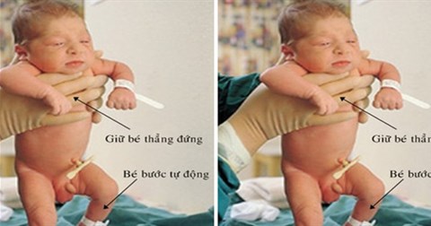 Lý giải hiện tượng kỳ lạ em bé vừa sinh ra đã bước đi như có phép màu