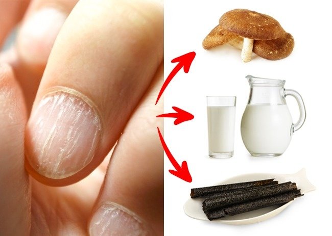 Móng tay và tóc dễ gãy