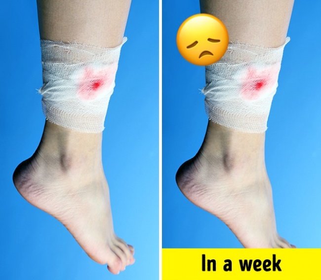 Các vết thương trên cơ thể lâu lành