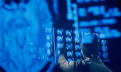 Dấu hiệu sự hồi sinh ở các bệnh nhân chết não sẽ được các thiết bị chụp ảnh não tìm kiếm