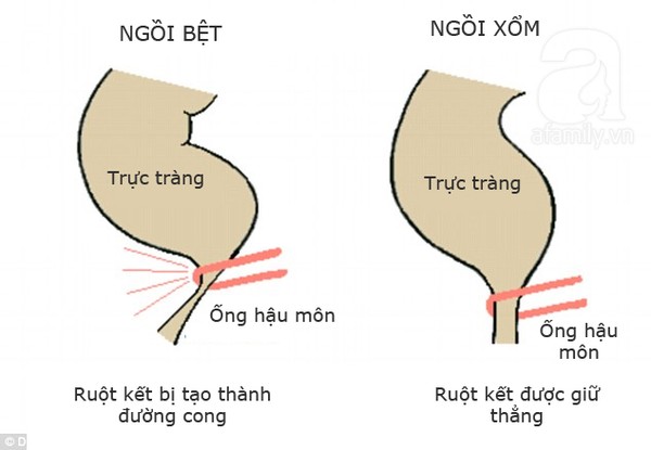 Sự khác biệt khi bạn ngồi xí xổm và xí bệt 