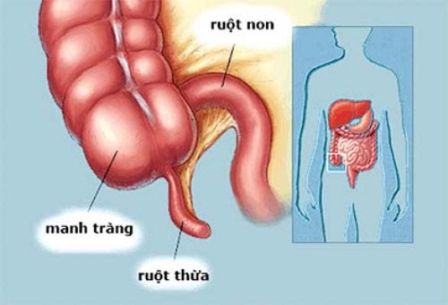 Ruột thừa là một trong những dấu tích của sự tiến hóa loài người từ vượn cổ