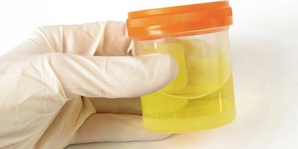 Nước tiểu có thể tạo ra điện 