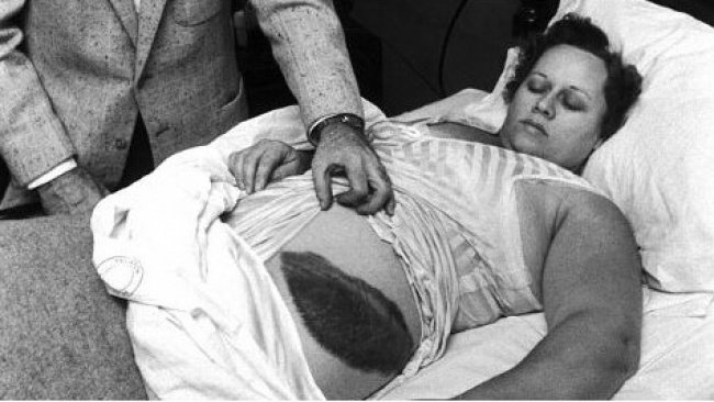 Ann Hodges là người duy nhất sống sót sau vụ va chạm thiên thạch