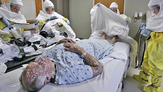 Đậu mùa từng gây ra một trong bốn đại dịch khủng khiếp nhất trong lịch sử