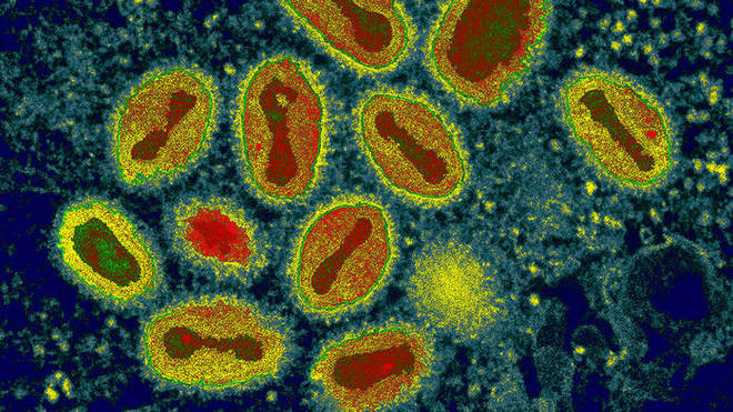 Việc giảm chi phí, đơn giản hóa quy trình và tìm cách tạo ra được nhiều loài virus tổng hợp chỉ là vấn đề thời gian