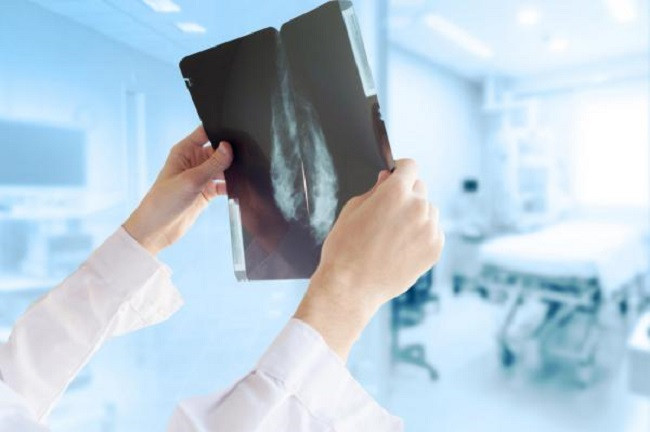 Thuốc điều trị ung thư vú