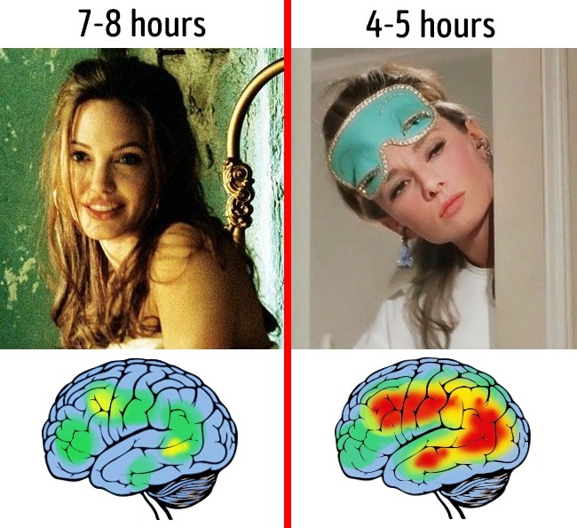 Việc thiếu ngủ khiến các tế bào não bộ bị tàn phá 