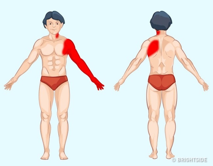 Vị trí đau báo hiệu vấn đề về TIM