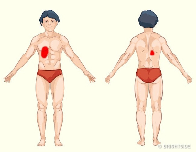 Vị trí đau báo hiệu vấn đề về TÚI MẬT và GAN