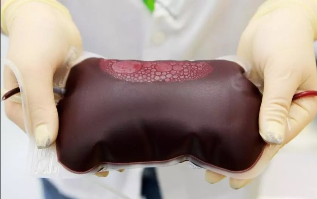 Bạn nên hiến máu thường xuyên dù thuộc nhóm nào 