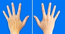 5 thói quen xấu khiến đôi tay của bạn già hơn mặt đến 10 tuổi