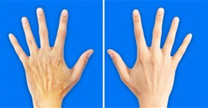 5 thói quen xấu khiến đôi tay của bạn già hơn mặt đến 10 tuổi