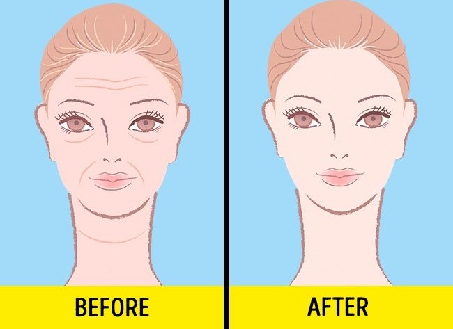 Giảm quá trình lão hóa