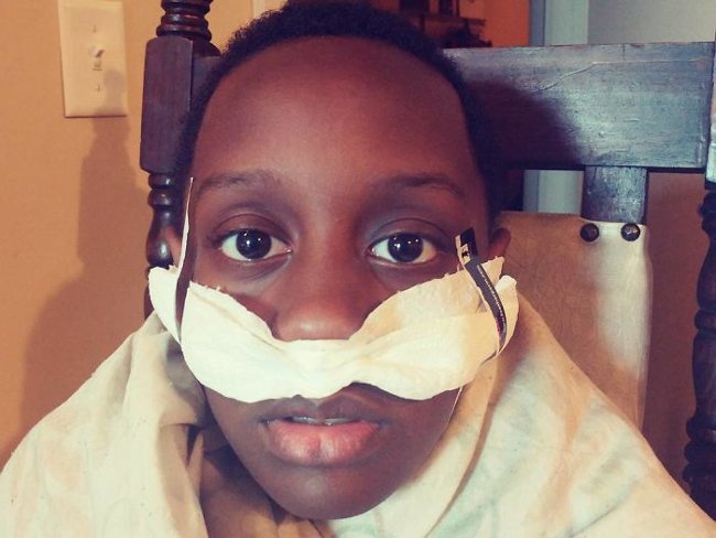 Khi bị "sổ mũi"!