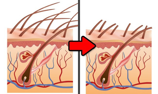 Khi bạn cạo lông, chúng bị cắt ngang ở giữa tạo thành một bề mặt sắc và thô ráp mỗi khi chạm vào