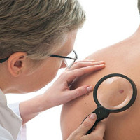 Trí tuệ nhân tạo có thể giúp phát hiện ung thư da u ác tính
