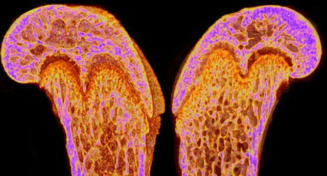 Hoóc-môn có nguồn gốc từ xương đảo ngược sự mất trí nhớ ở chuột