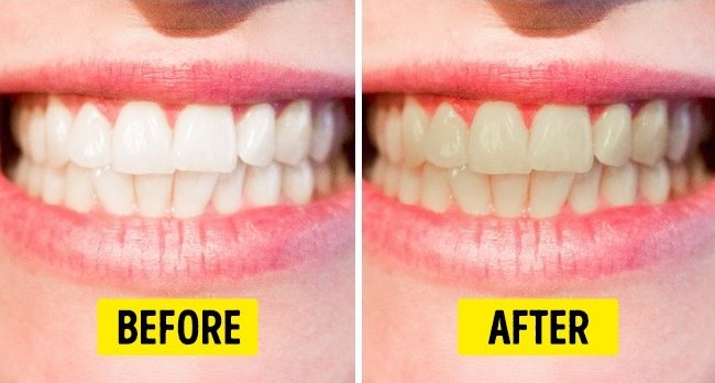 Gây hại cho răng