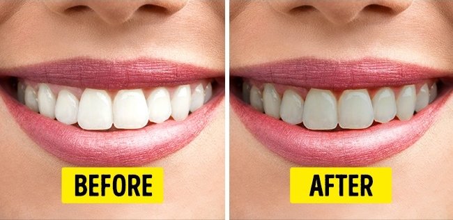 Rượu vang đỏ gây hại cho răng