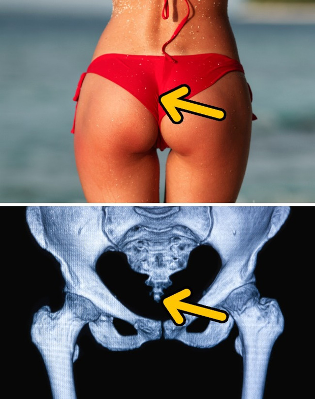 Xương cụt không có cũng không sao