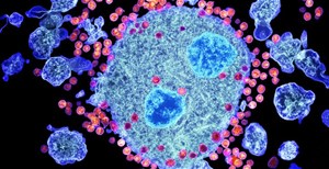 Tin vui: tìm ra kháng thể mới có thể tiêu diệt 99% chủng virus HIV