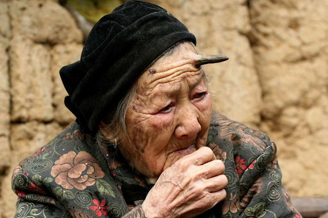 Bà Zhang Ruifang "mọc sừng" ở trán  