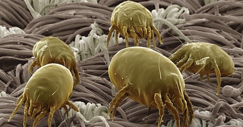 Thế giới xung quanh trông như thế nào khi quan sát dưới lăng kính hiển vi