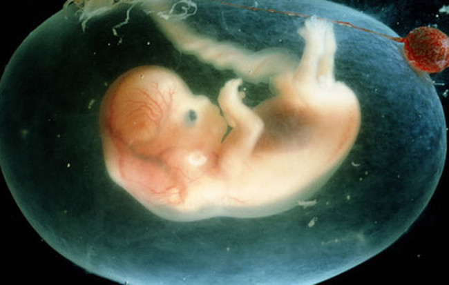 Trong tương lai những đứa trẻ sẽ không bao giờ mắc bệnh?